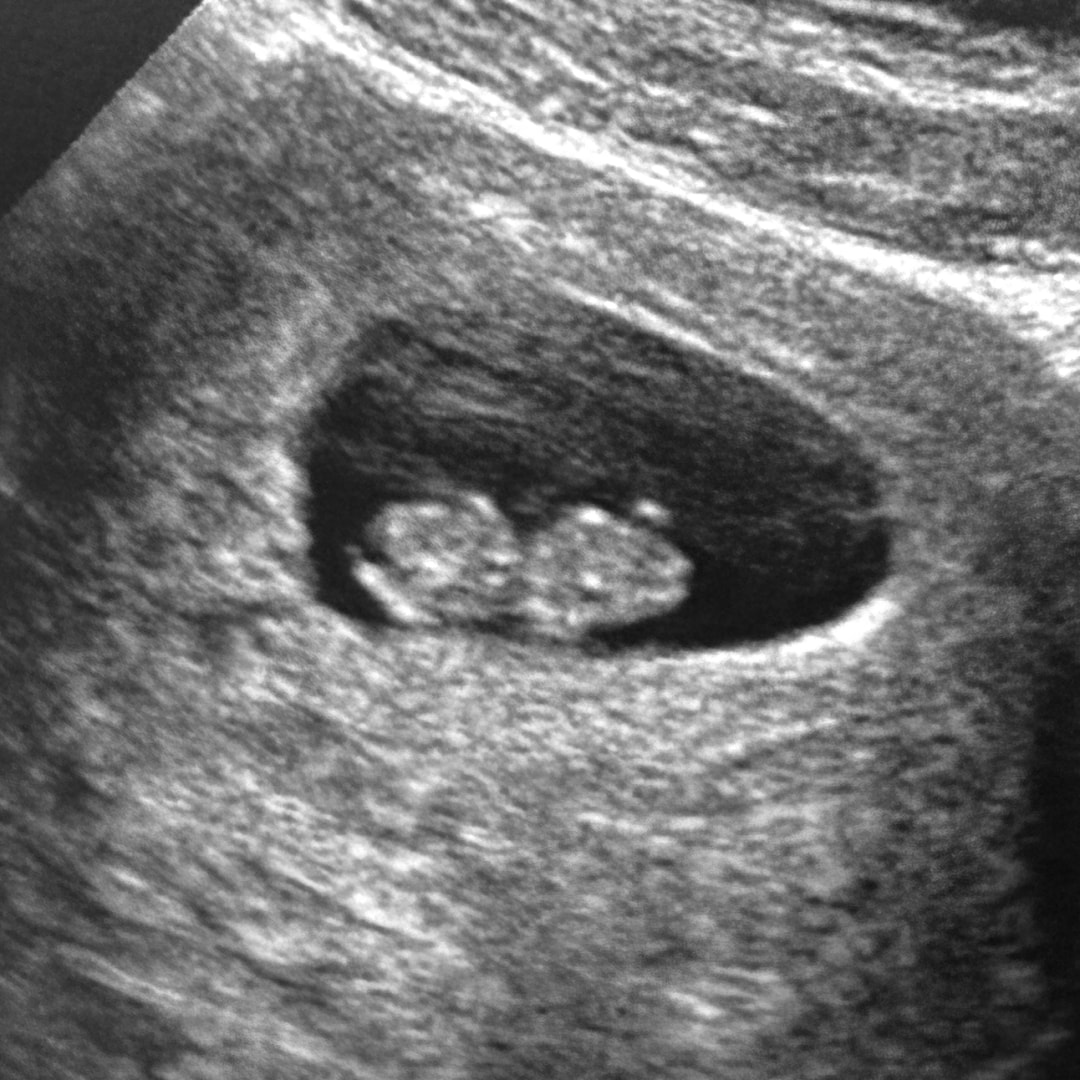 Photo shared by Alexa for their Babylist baby registry.