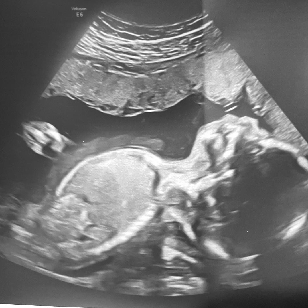 Photo shared by Jamie for their Babylist baby registry.