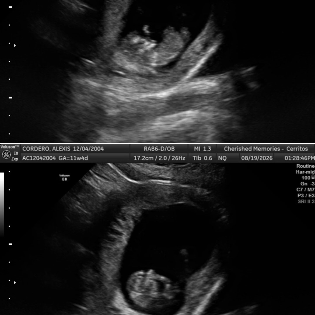 Photo shared by Alexis for their Babylist baby registry.