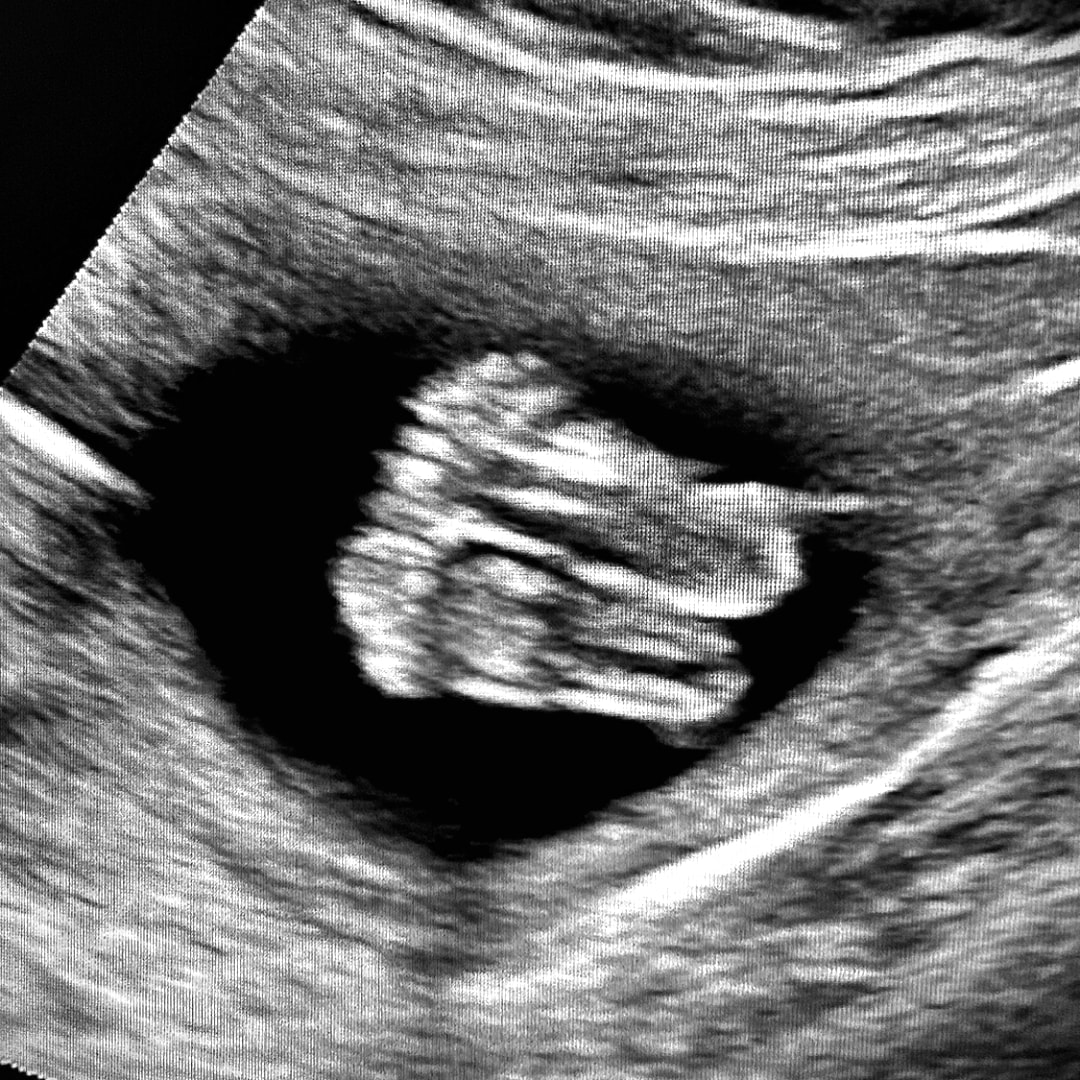 Photo shared by Inez for their Babylist baby registry.