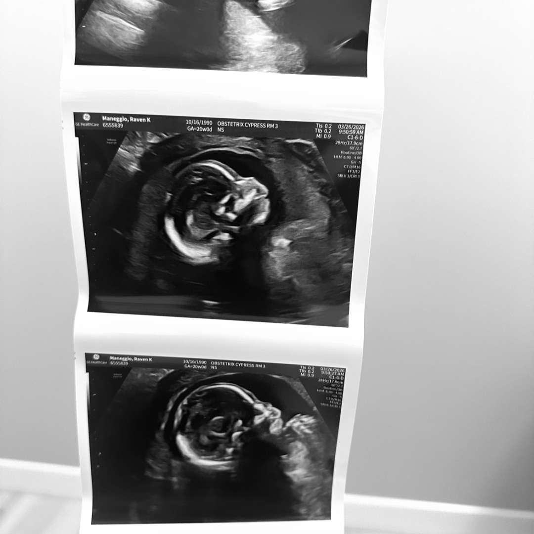 Photo shared by Raven for their Babylist baby registry.