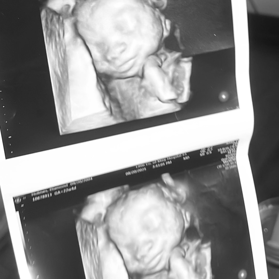 Photo shared by Diamond for their Babylist baby registry.