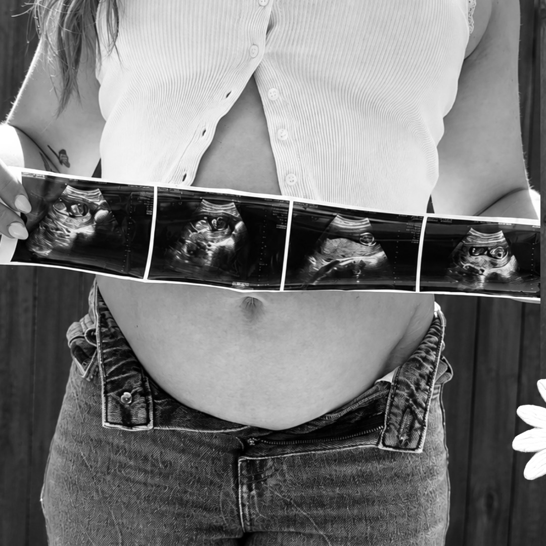 Photo shared by Kelsey for their Babylist baby registry.