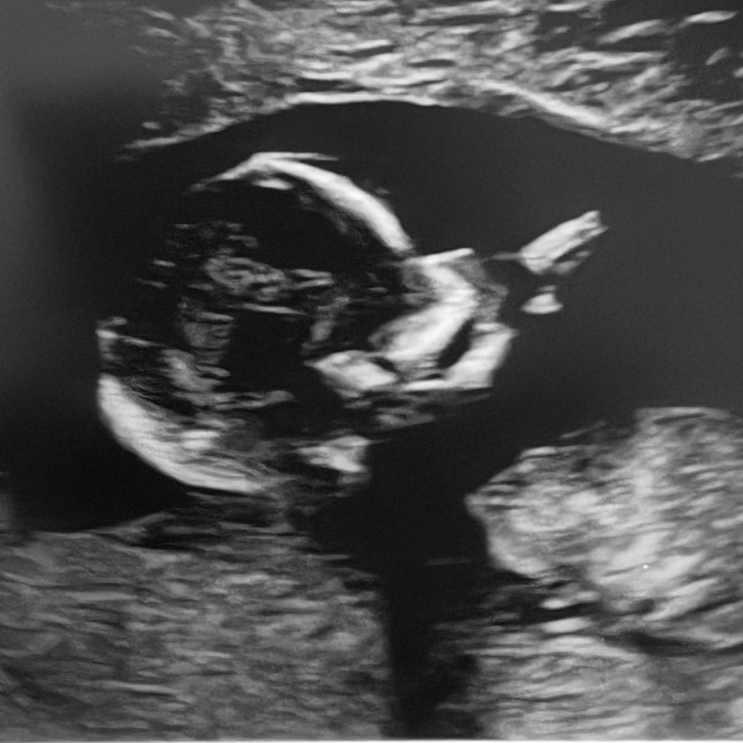 Photo shared by Haley for their Babylist baby registry.
