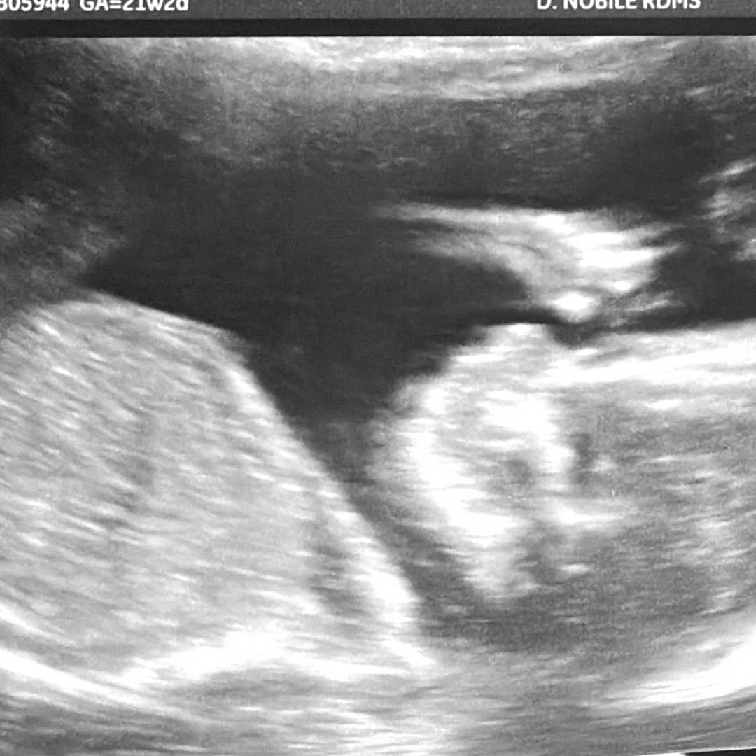 Photo shared by Samantha for their Babylist baby registry.