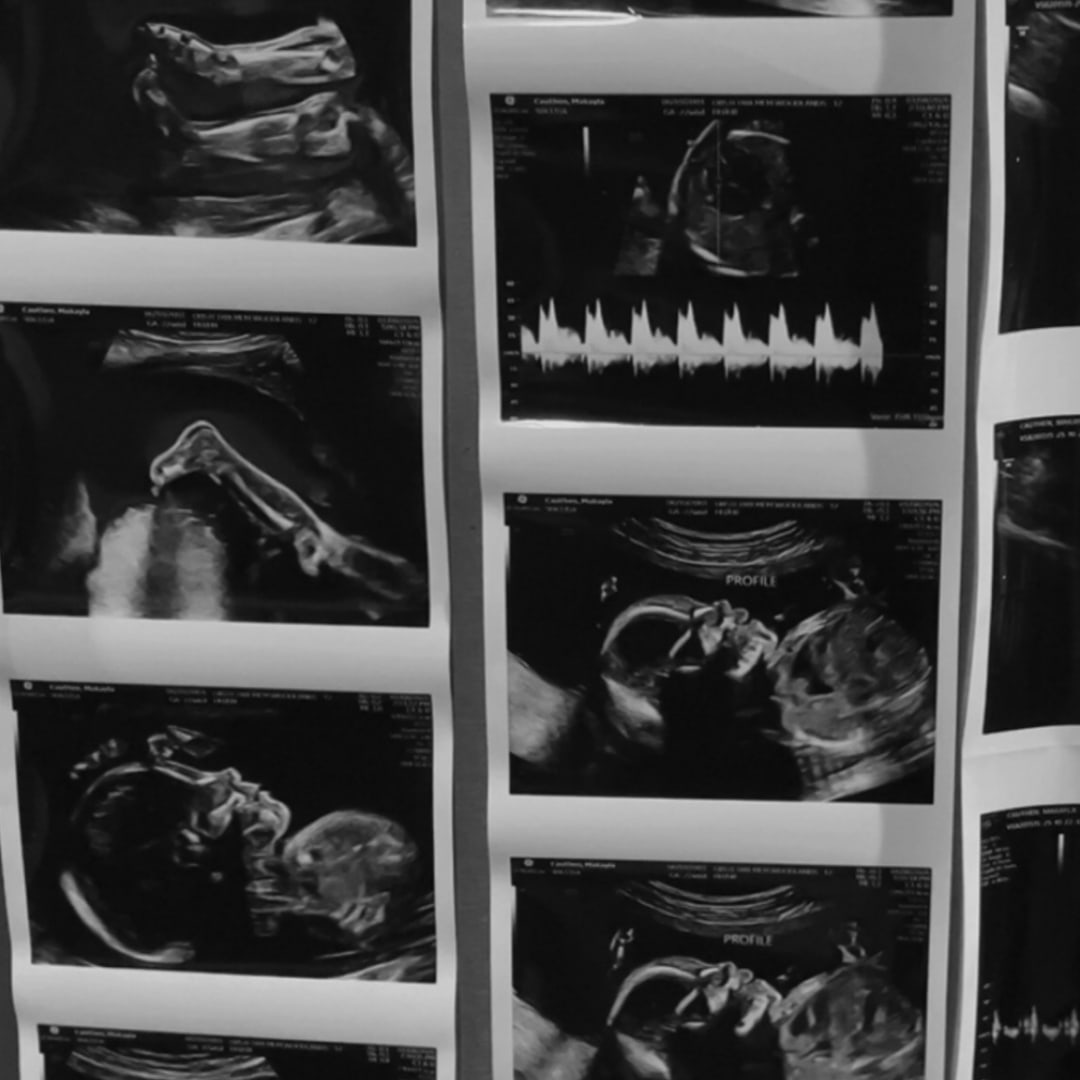 Photo shared by Makayla for their Babylist baby registry.