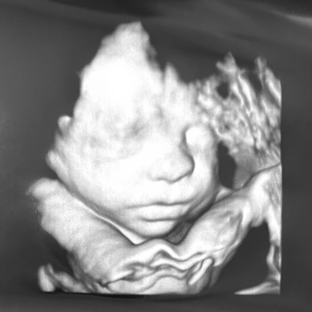 Photo shared by Caroline for their Babylist baby registry.