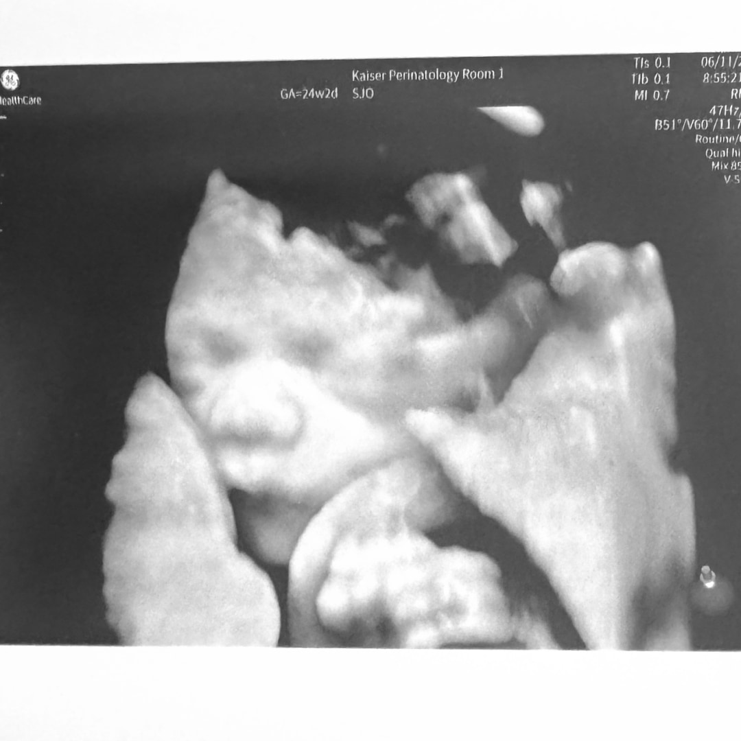 Photo shared by Christie for their Babylist baby registry.