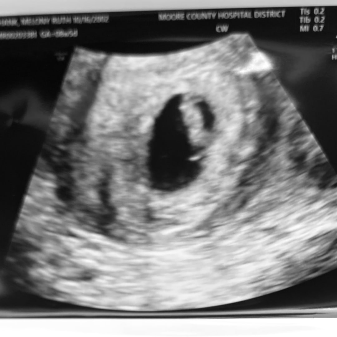 Photo shared by Melony for their Babylist baby registry.