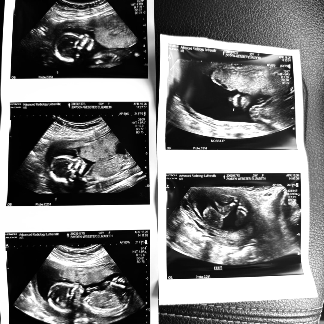 Photo shared by Elizabeth for their Babylist baby registry.