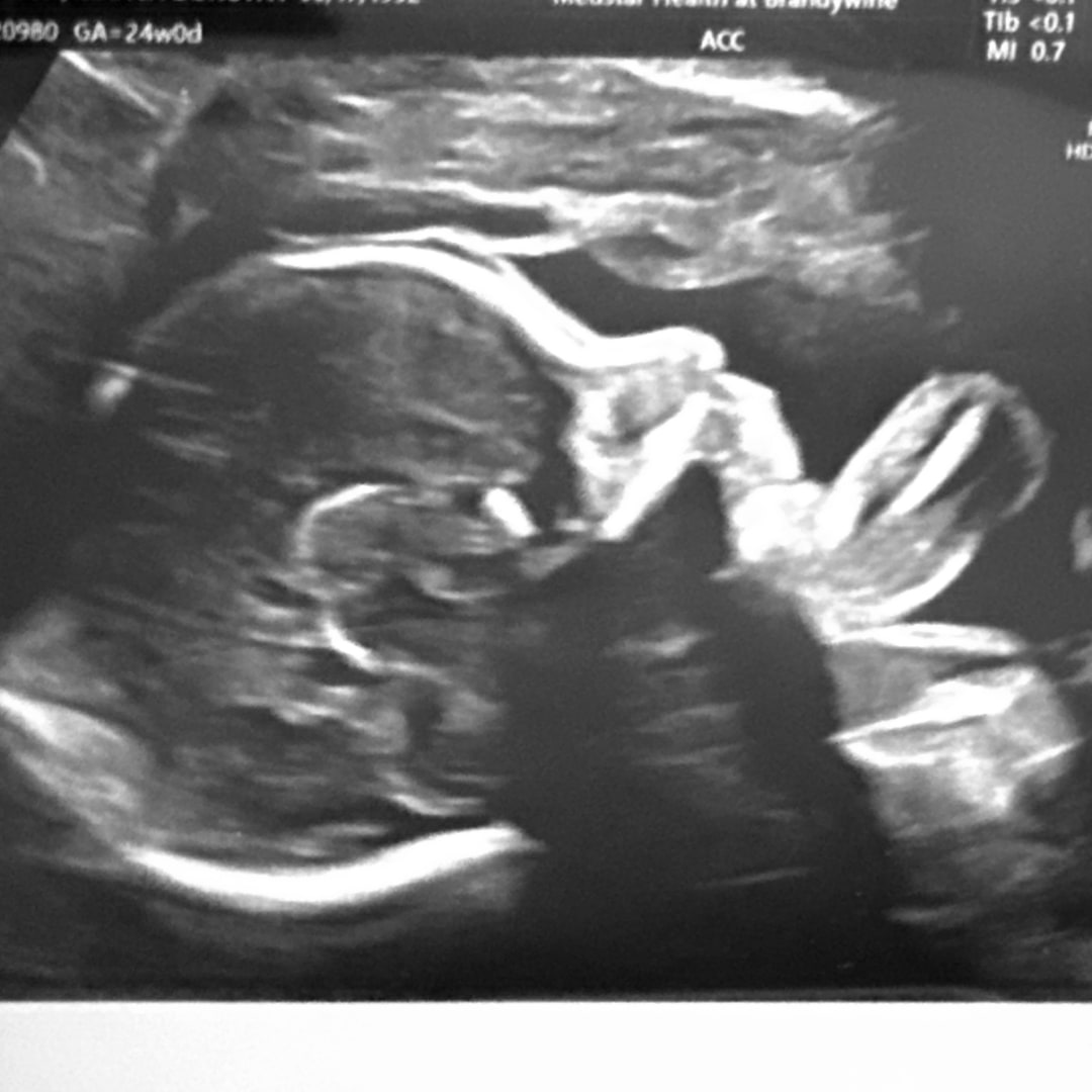 Photo shared by Bianca for their Babylist baby registry.