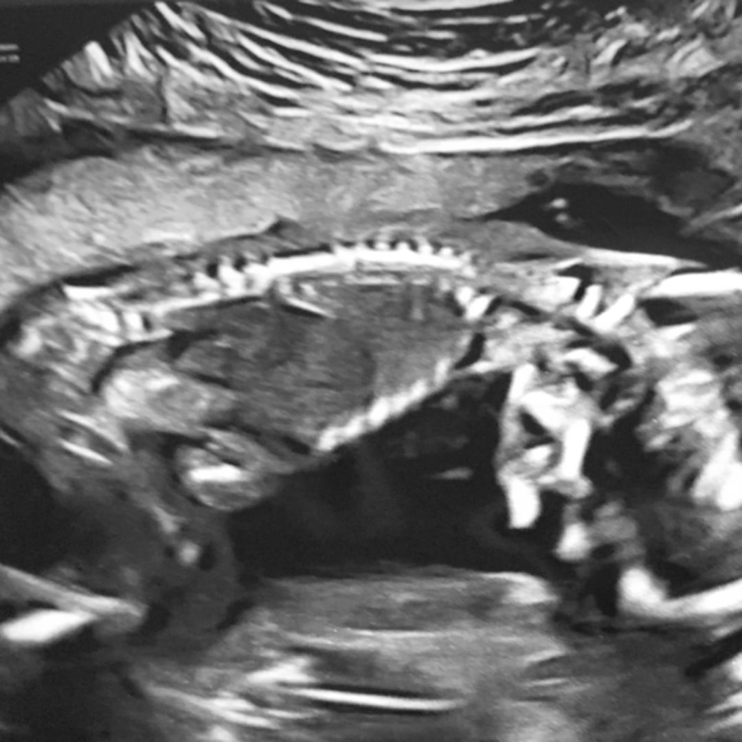 Photo shared by Aryanna for their Babylist baby registry.