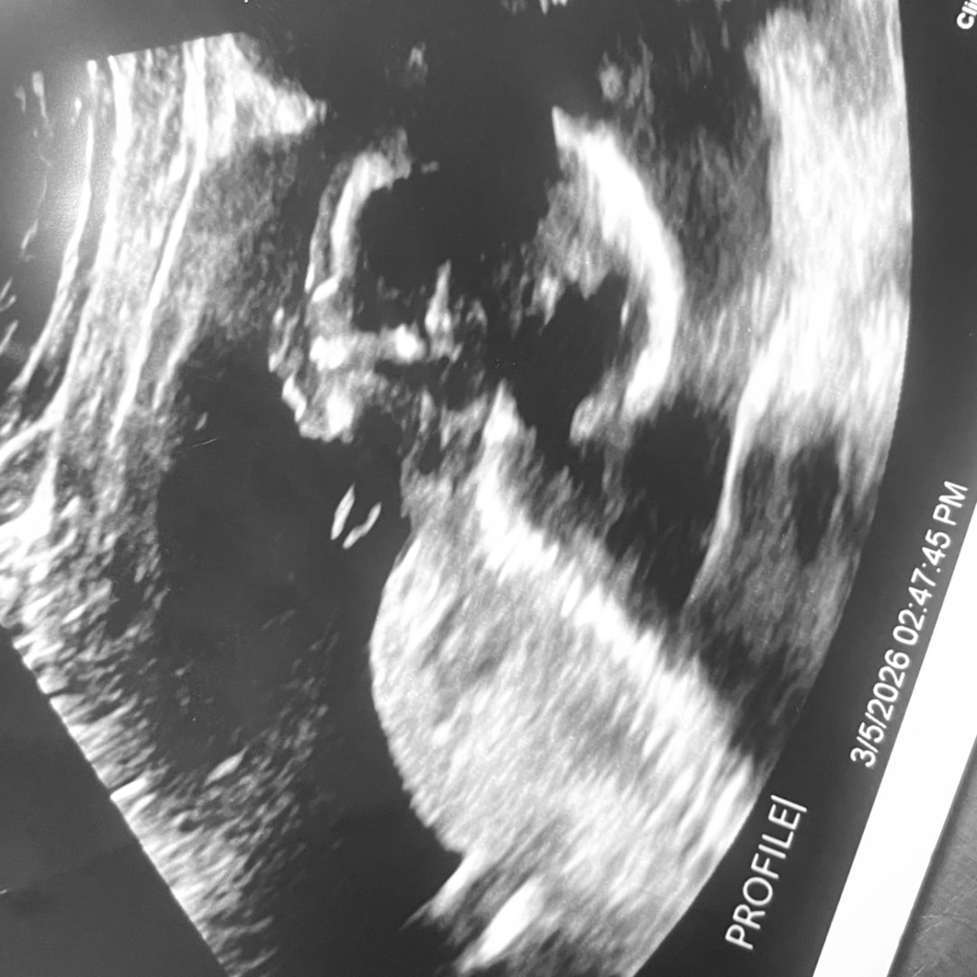 Photo shared by Cheyenne for their Babylist baby registry.