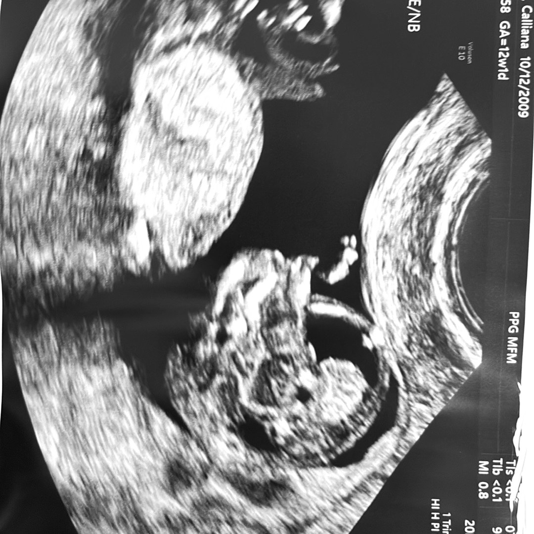 Photo shared by Calliana for their Babylist baby registry.