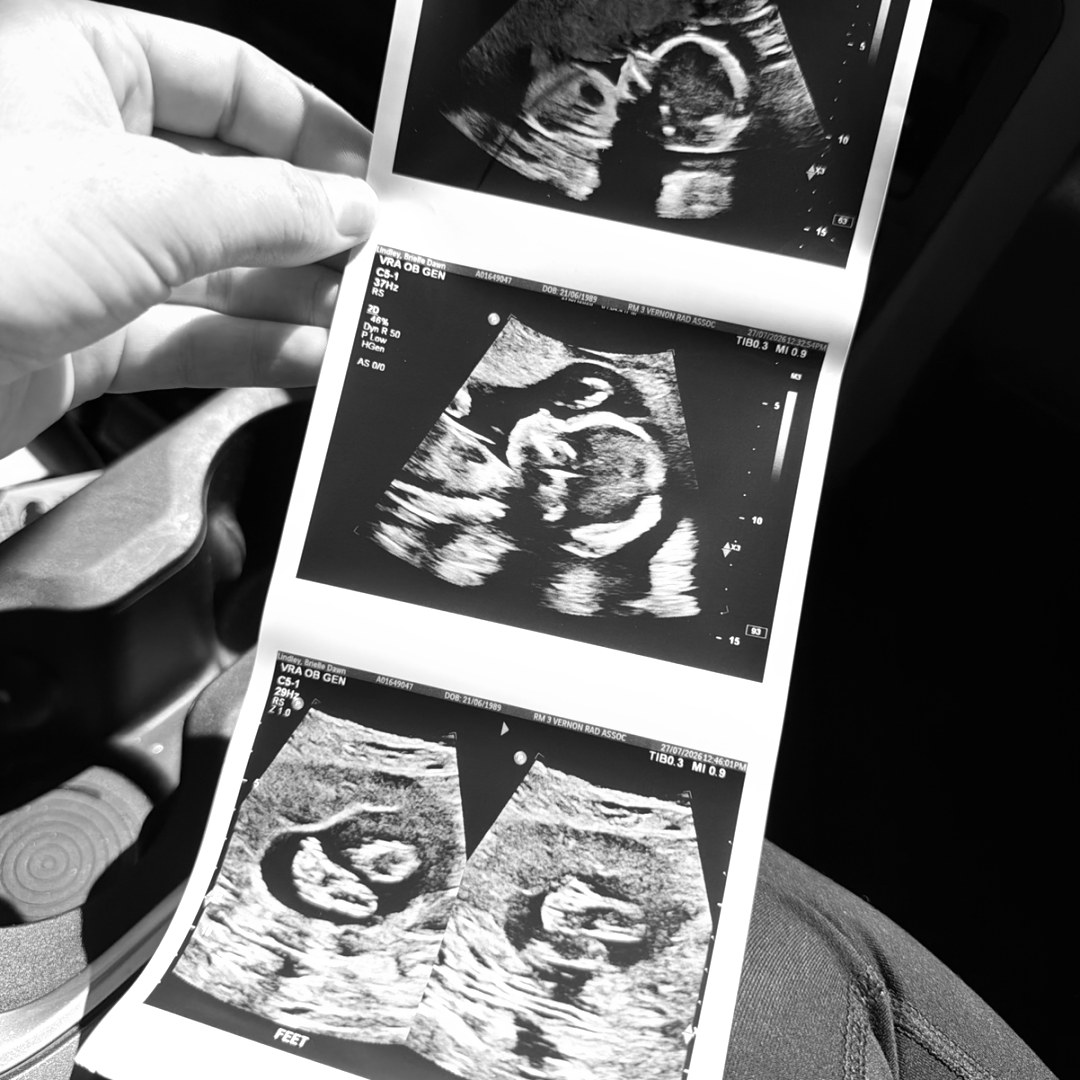 Photo shared by Brielle for their Babylist baby registry.