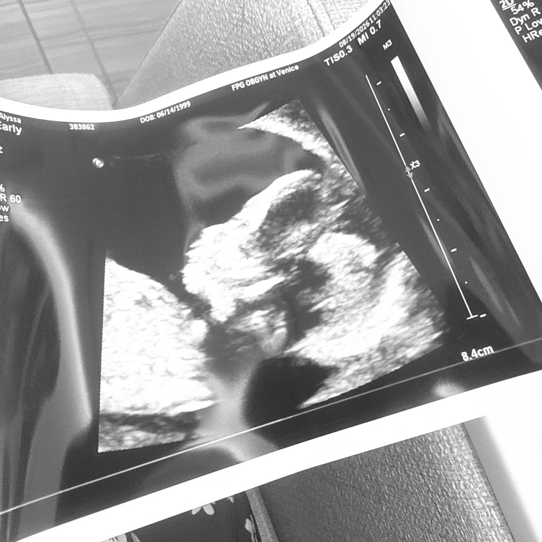Photo shared by Alyssa for their Babylist baby registry.