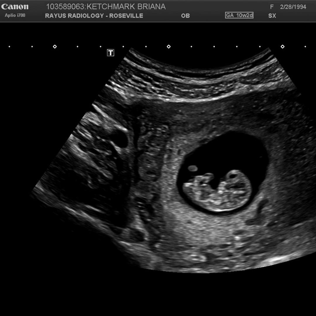 Photo shared by Briana for their Babylist baby registry.