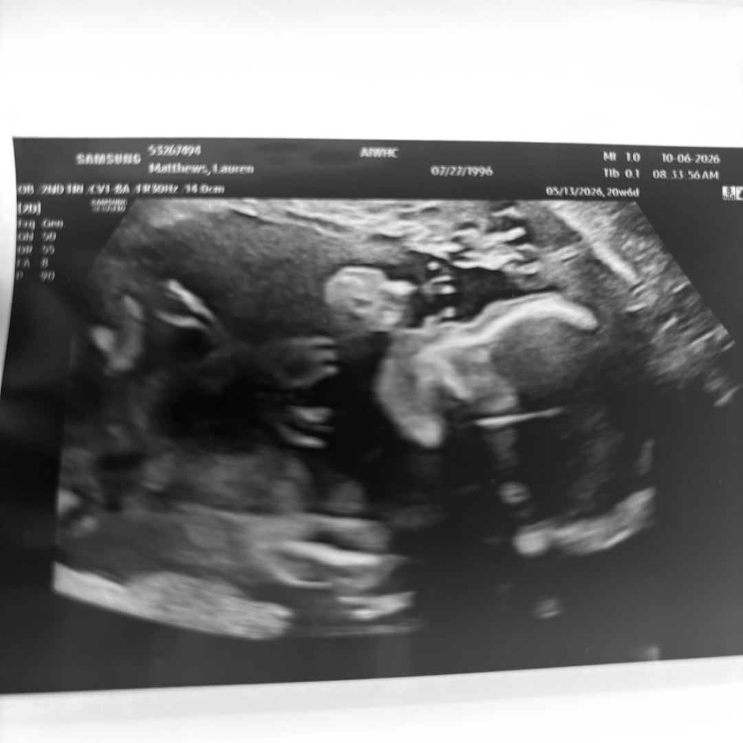 Photo shared by Lauren for their Babylist baby registry.