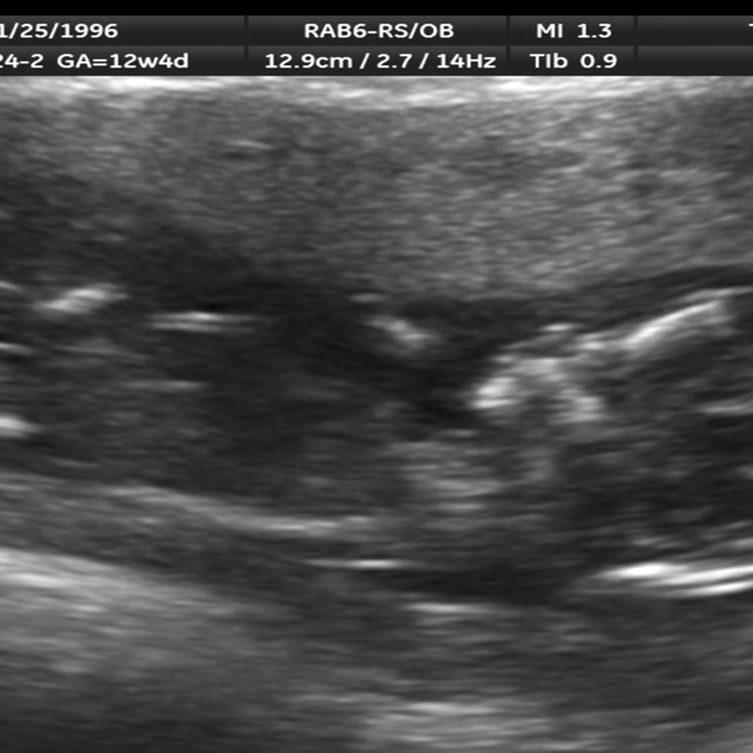 Photo shared by Rachel for their Babylist baby registry.