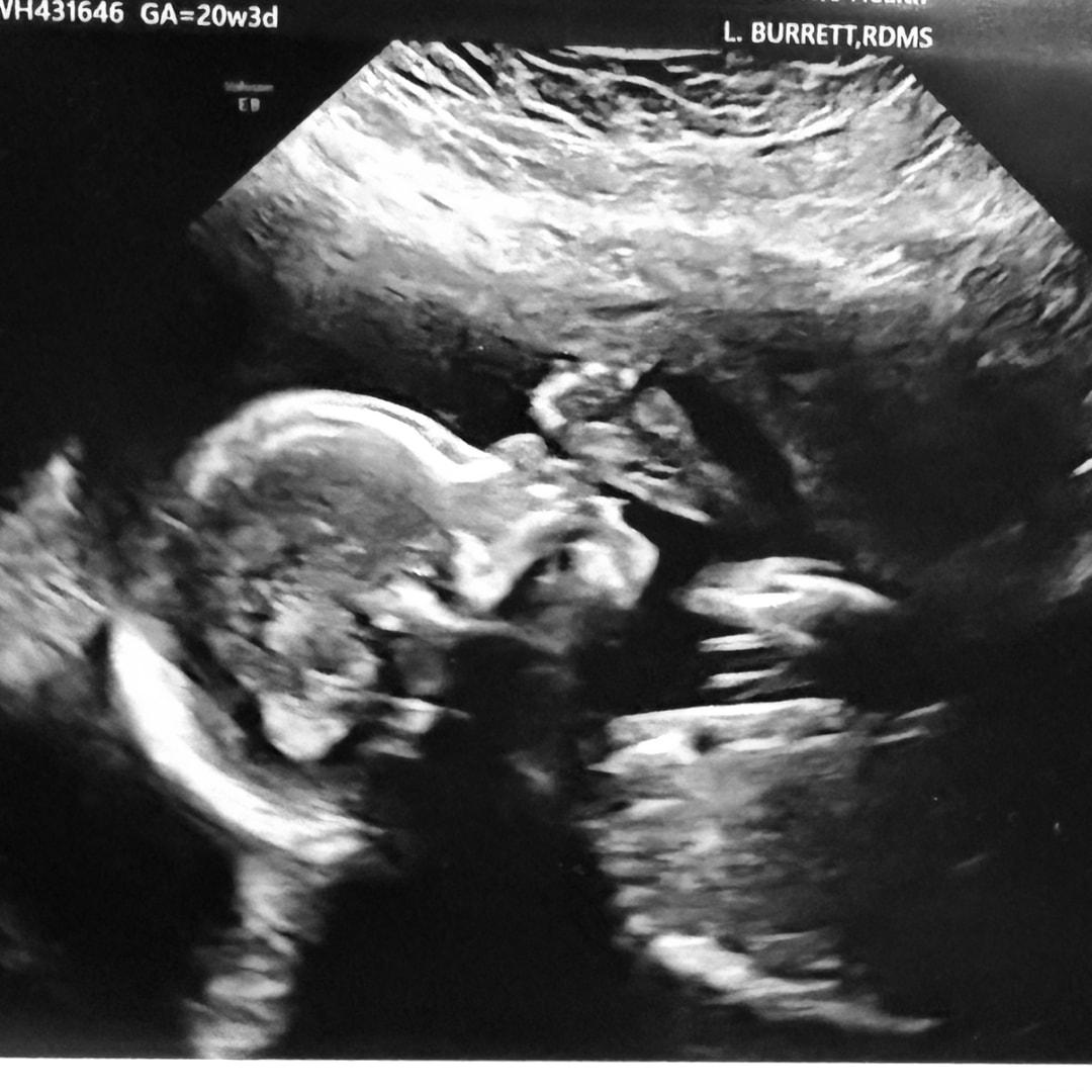 Photo shared by Ivette for their Babylist baby registry.