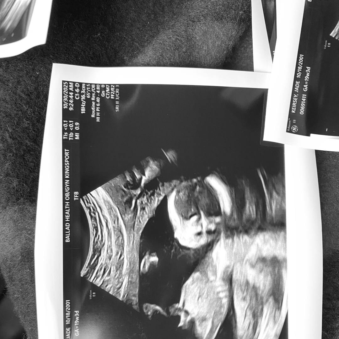 Photo shared by Jade for their Babylist baby registry.