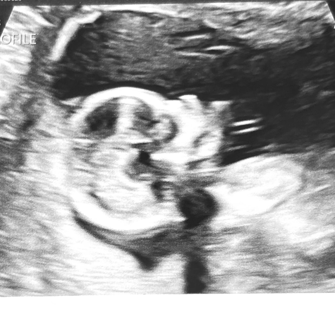 Photo shared by Courtney for their Babylist baby registry.