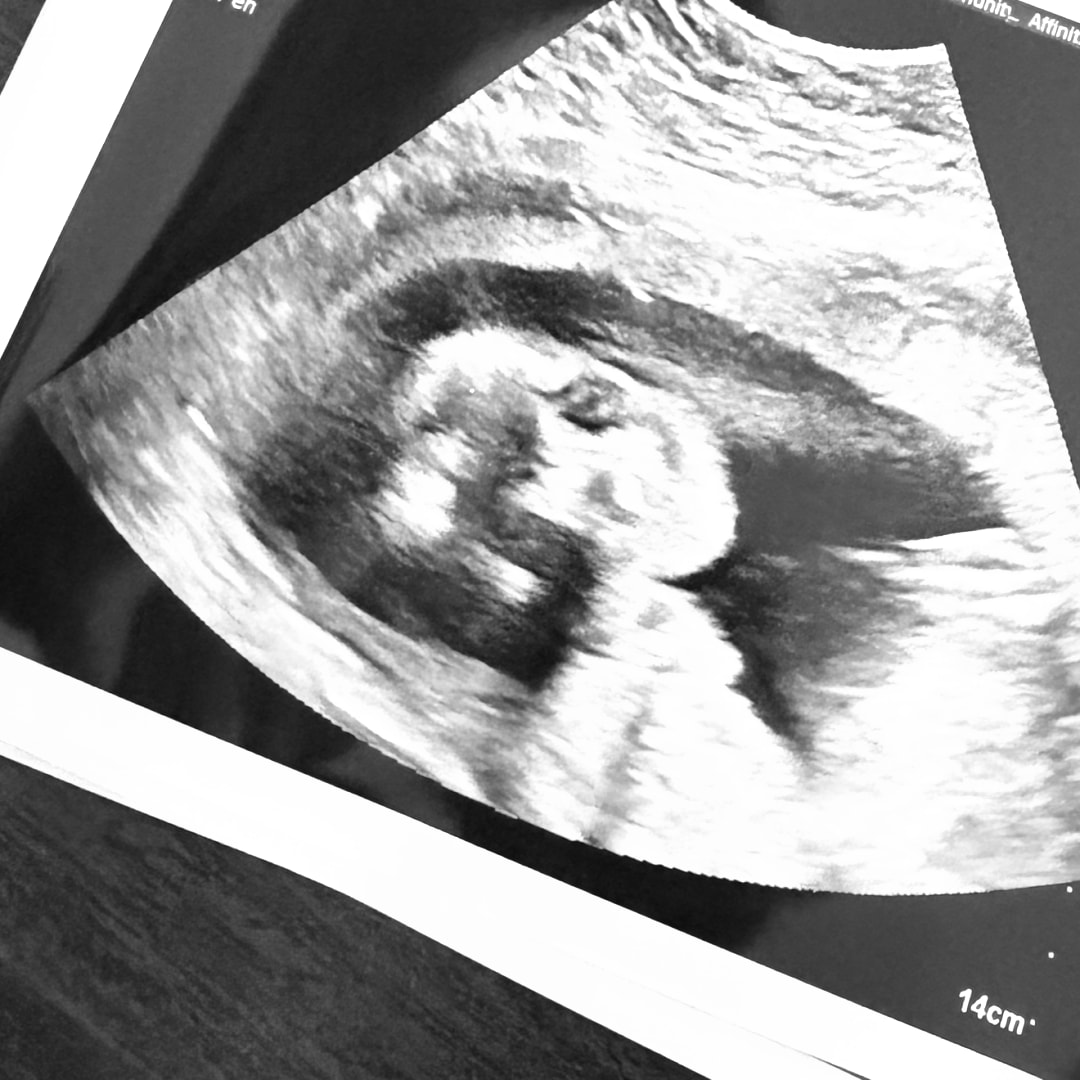Photo shared by Katlyn for their Babylist baby registry.
