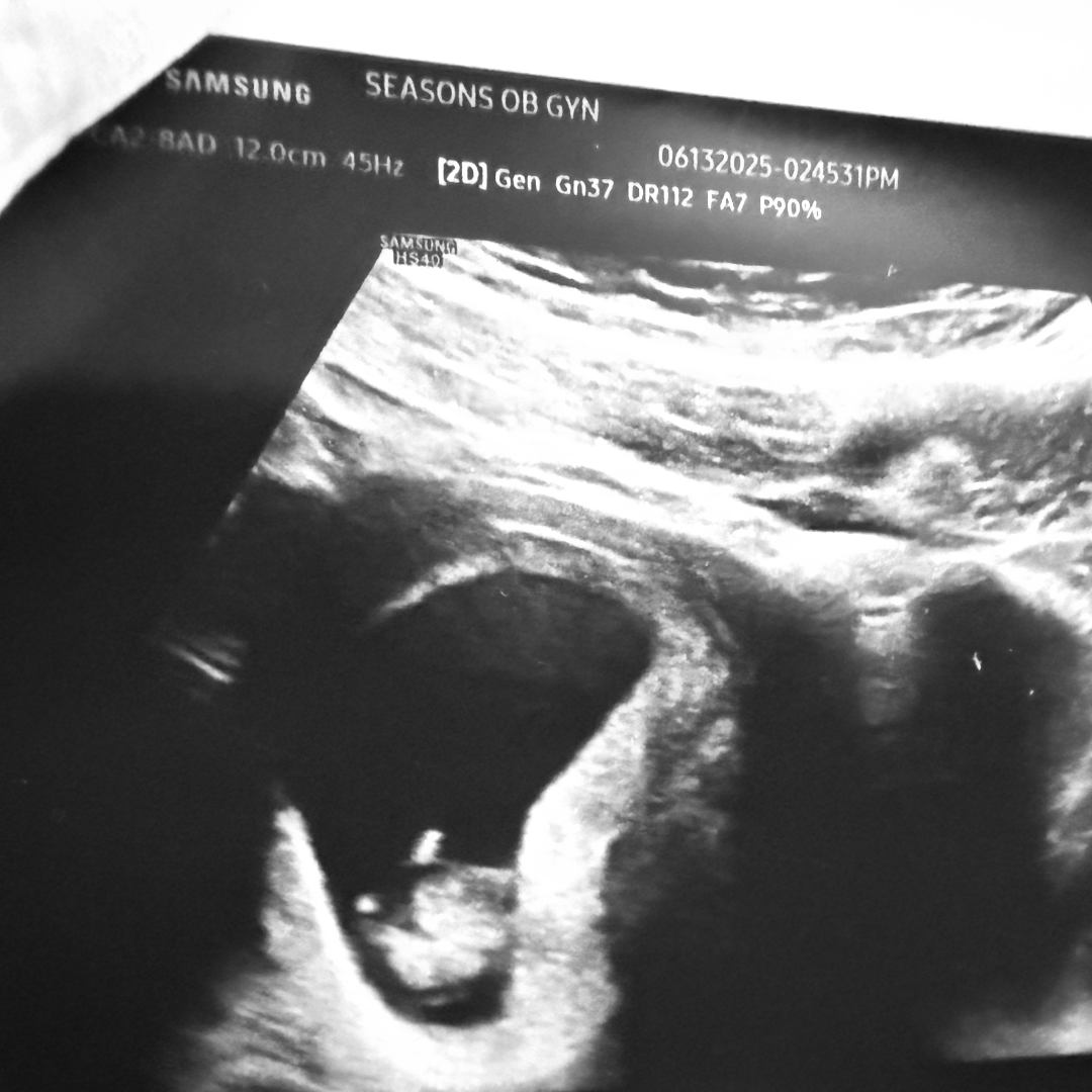 Photo shared by Laura for their Babylist baby registry.