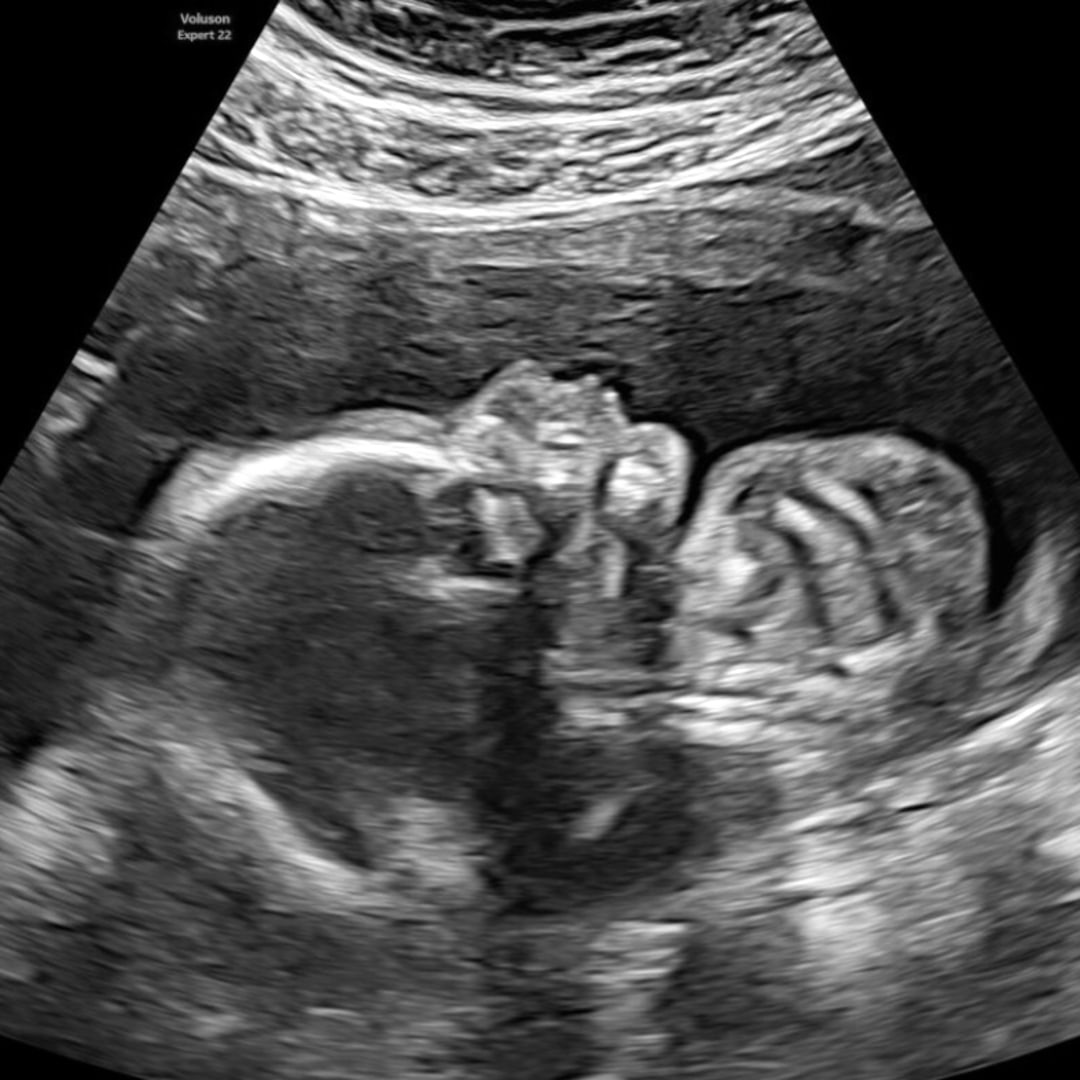 Photo shared by Chealsea for their Babylist baby registry.