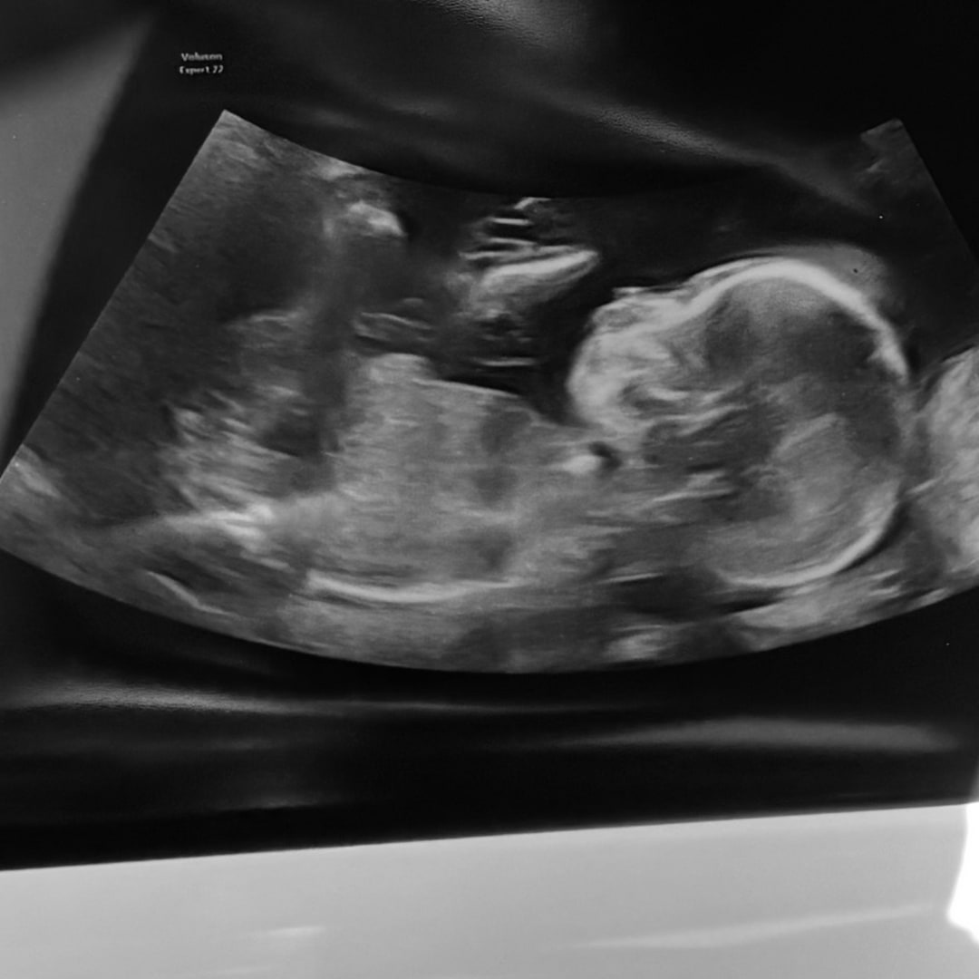 Photo shared by Amber for their Babylist baby registry.