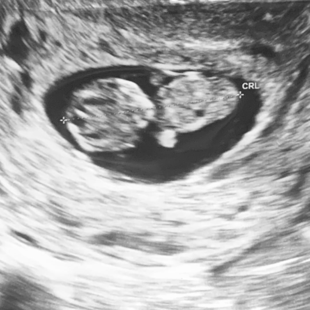 Photo shared by Genesis for their Babylist baby registry.