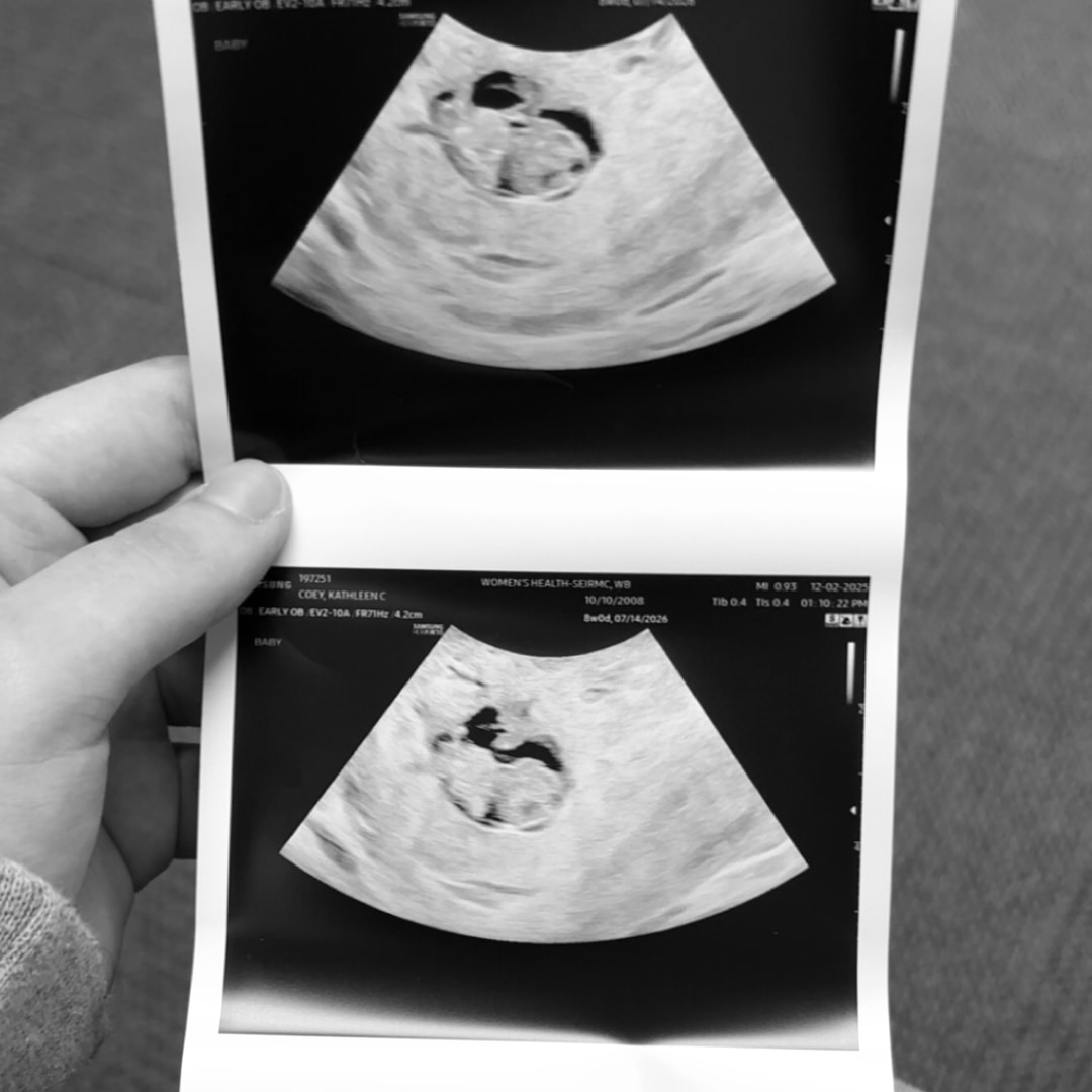 Photo shared by Kathleen for their Babylist baby registry.