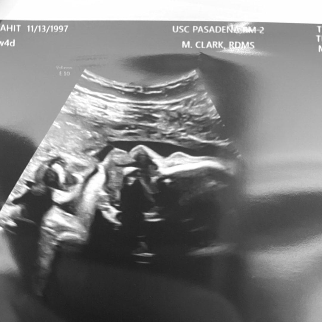 Photo shared by Anahit for their Babylist baby registry.