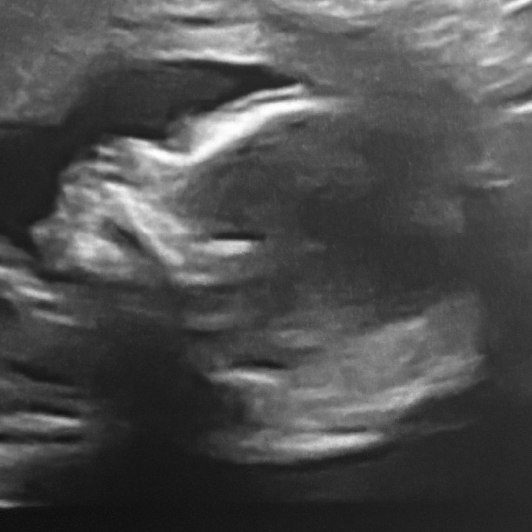 Photo shared by Rachel for their Babylist baby registry.