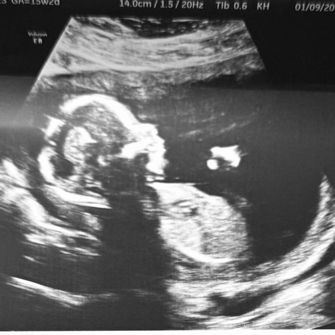 Photo shared by Payton for their Babylist baby registry.