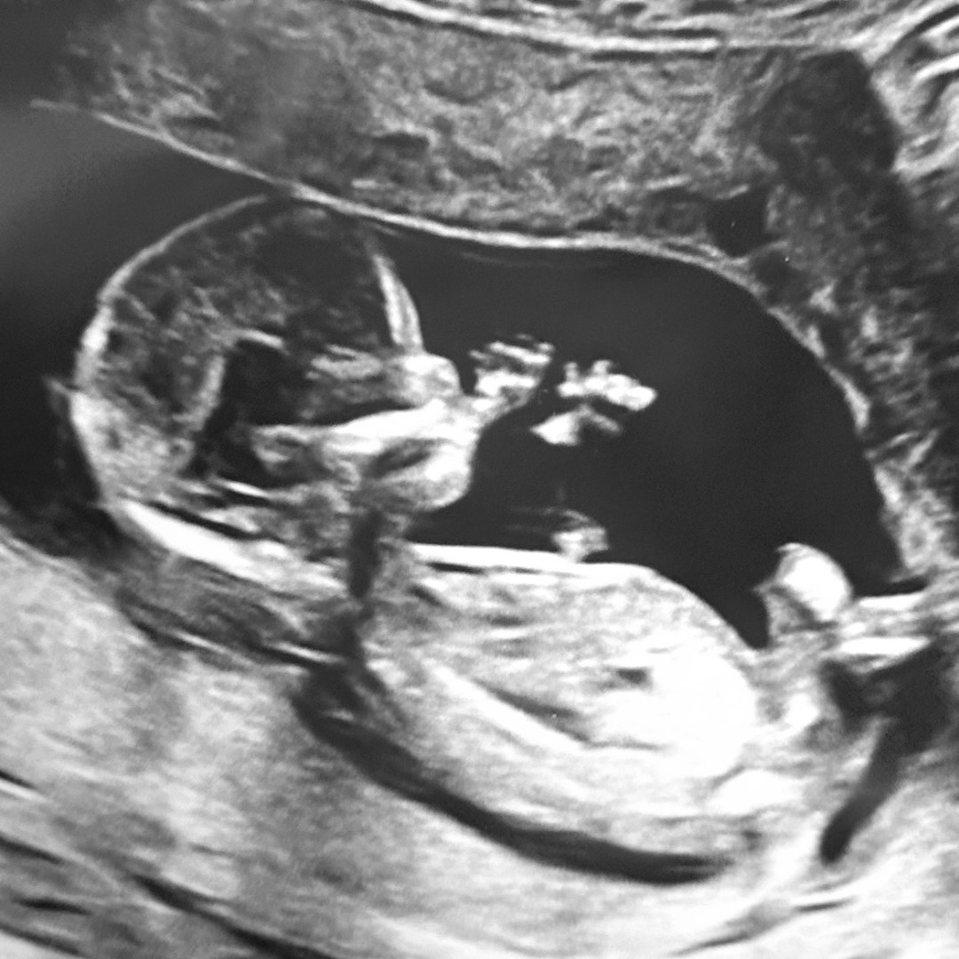 Photo shared by Tiffany for their Babylist baby registry.