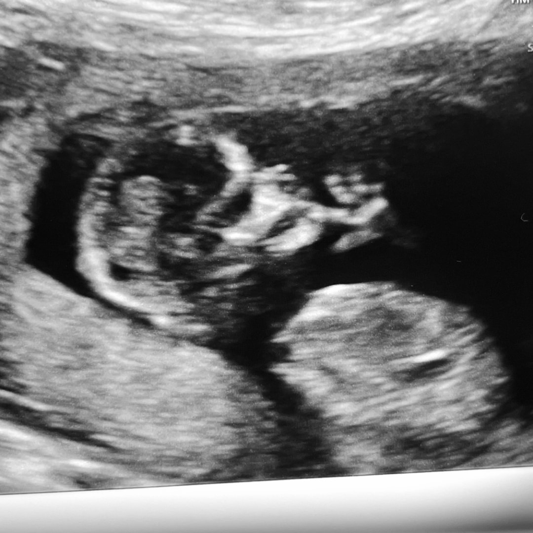 Photo shared by Claudia for their Babylist baby registry.
