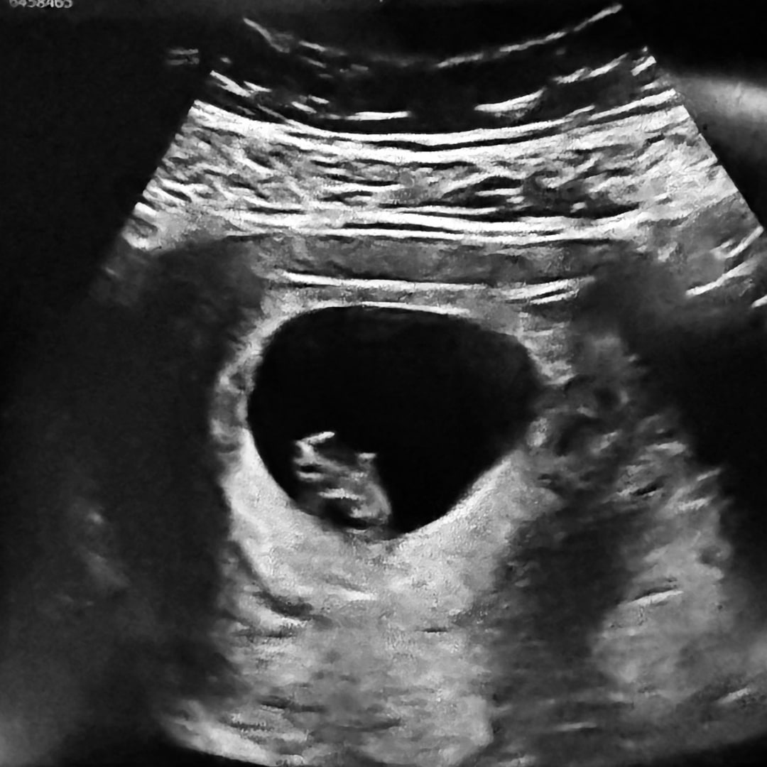 Photo shared by Jenny for their Babylist baby registry.