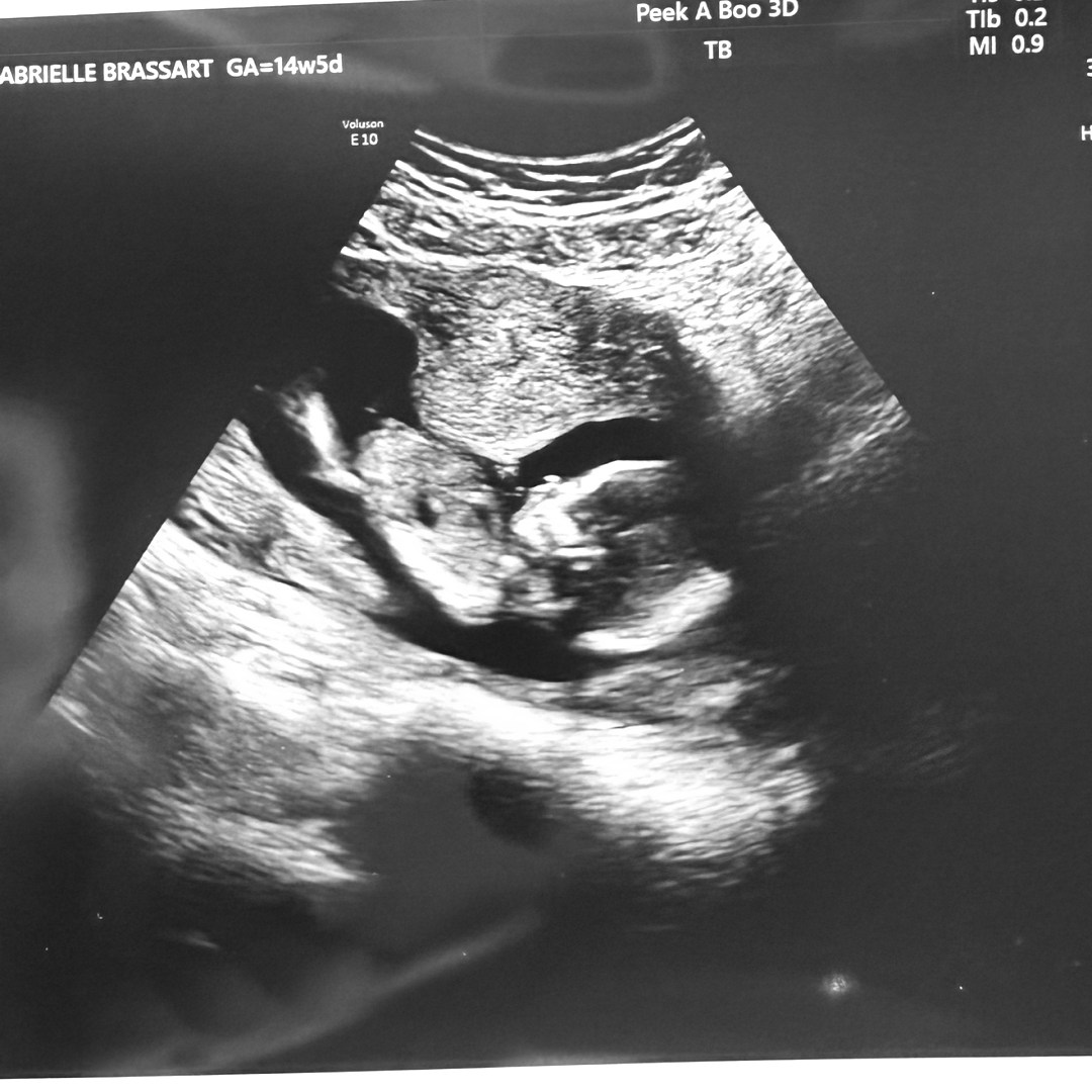 Photo shared by Gabby for their Babylist baby registry.