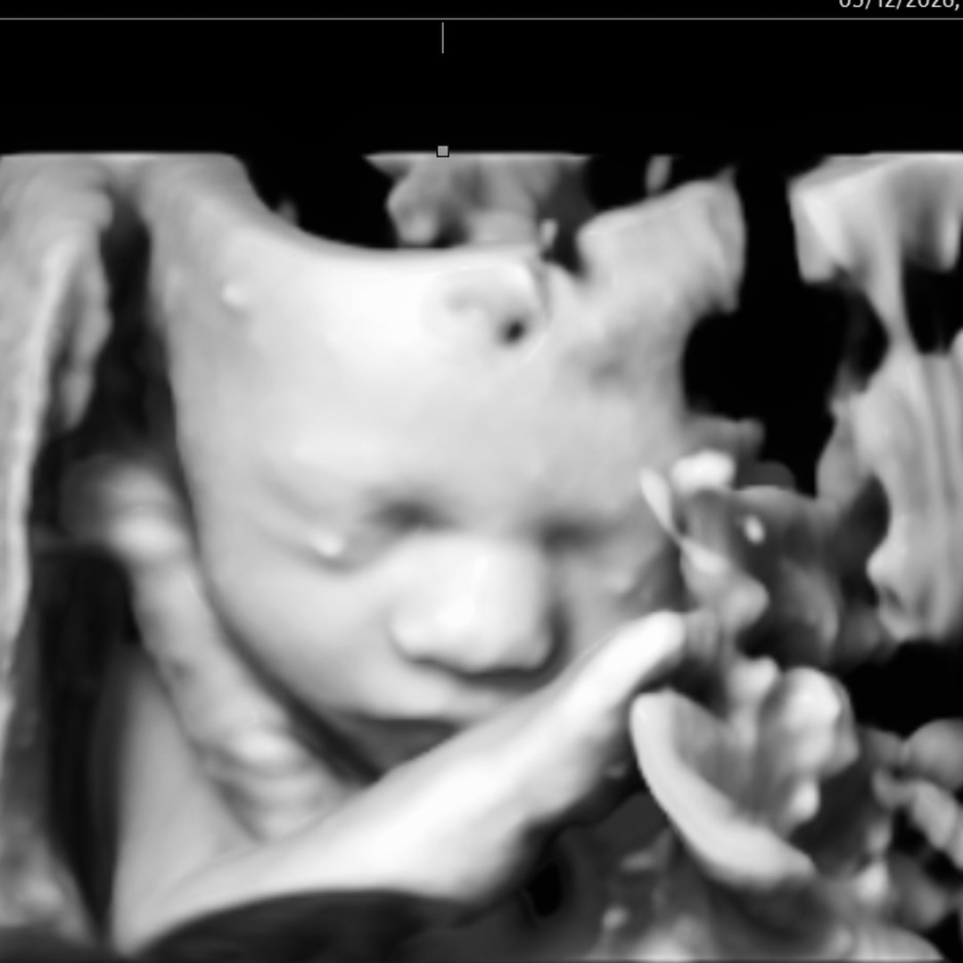 Photo shared by Hannah for their Babylist baby registry.