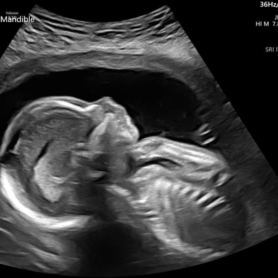 Photo shared by Corinne for their Babylist baby registry.