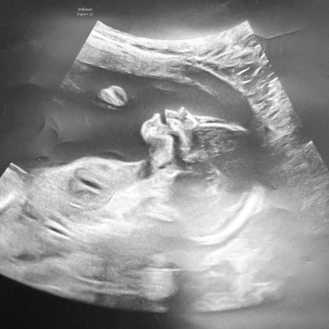 Photo shared by Olivia for their Babylist baby registry.