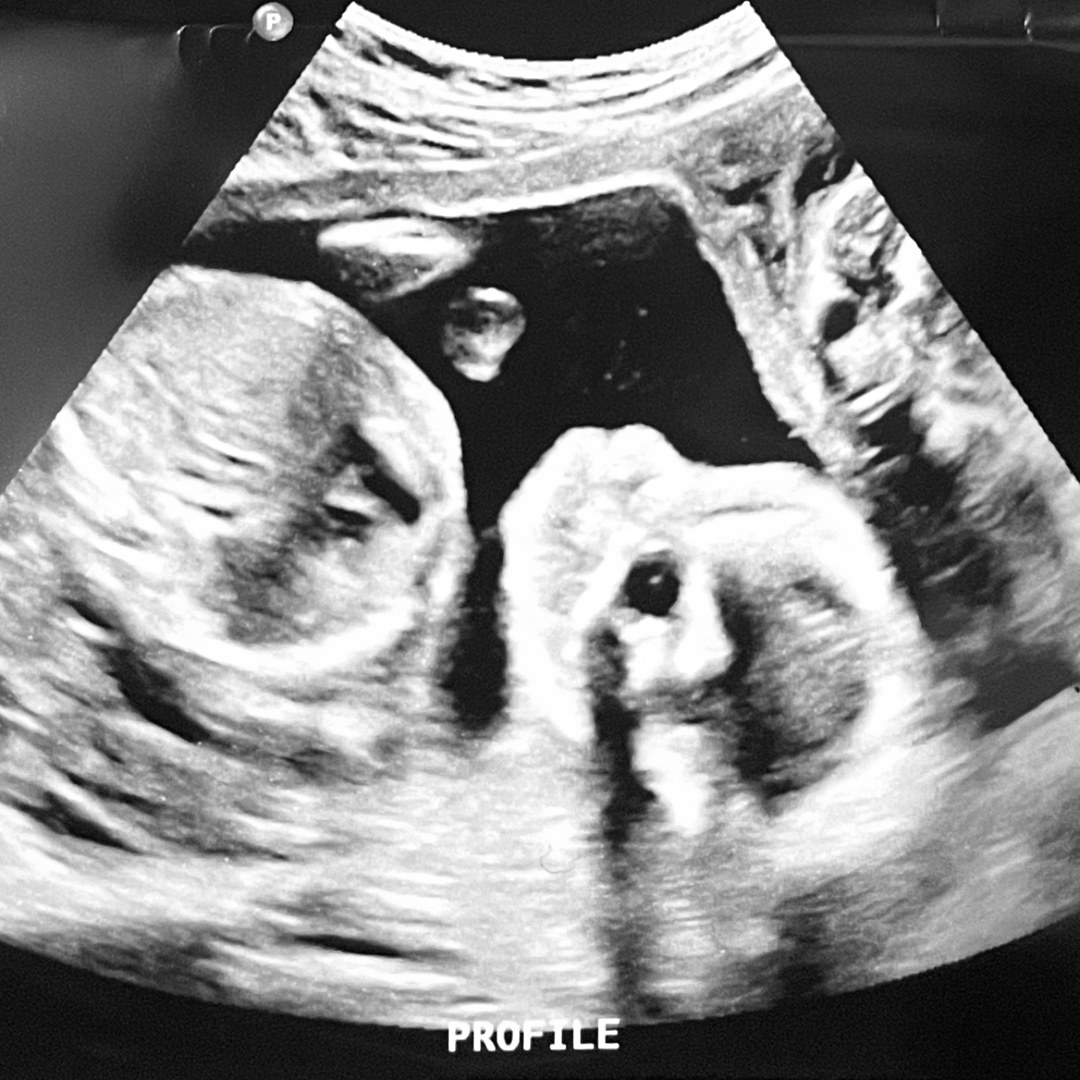 Photo shared by Leslie for their Babylist baby registry.