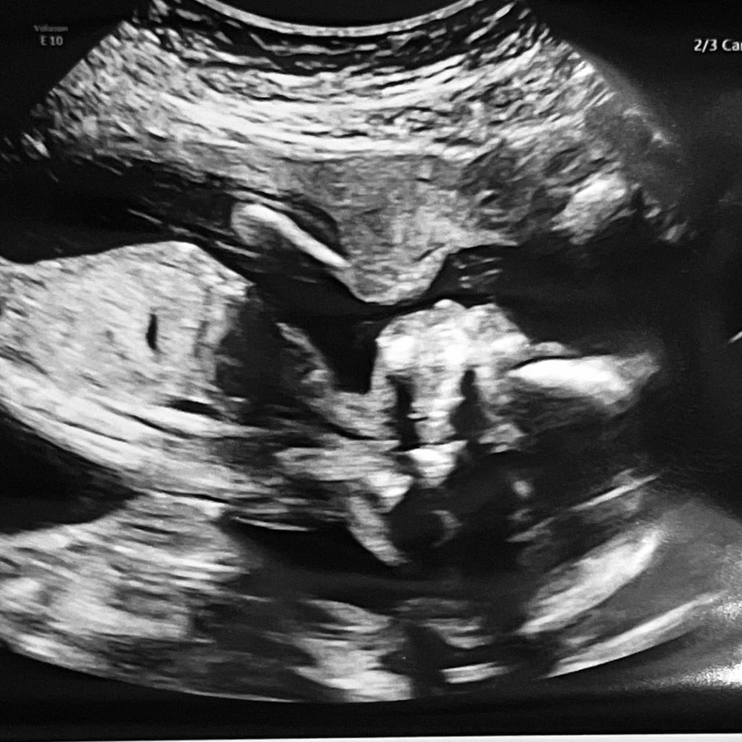 Photo shared by Isabelle for their Babylist baby registry.