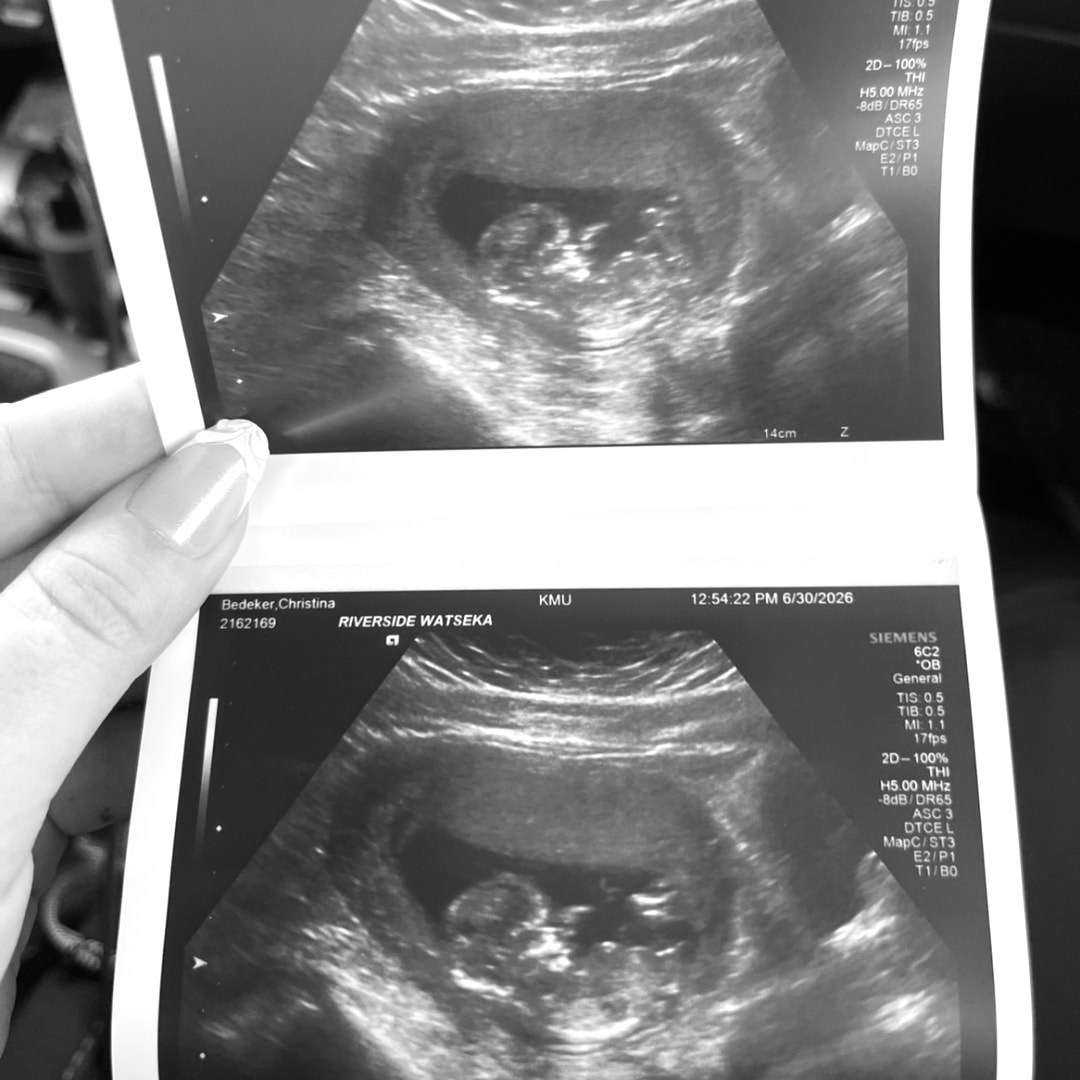 Photo shared by Christina for their Babylist baby registry.