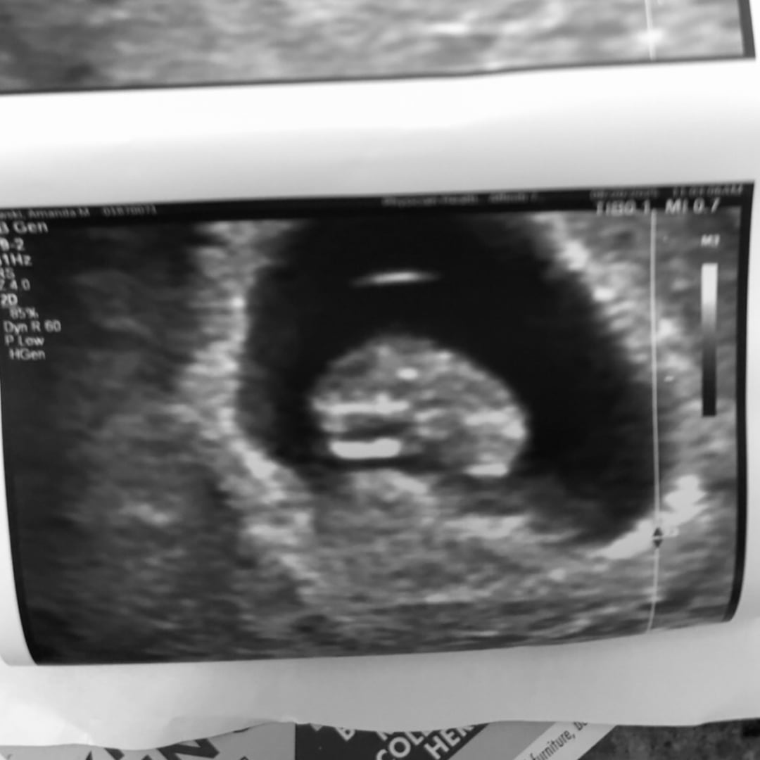 Photo shared by Amanda for their Babylist baby registry.