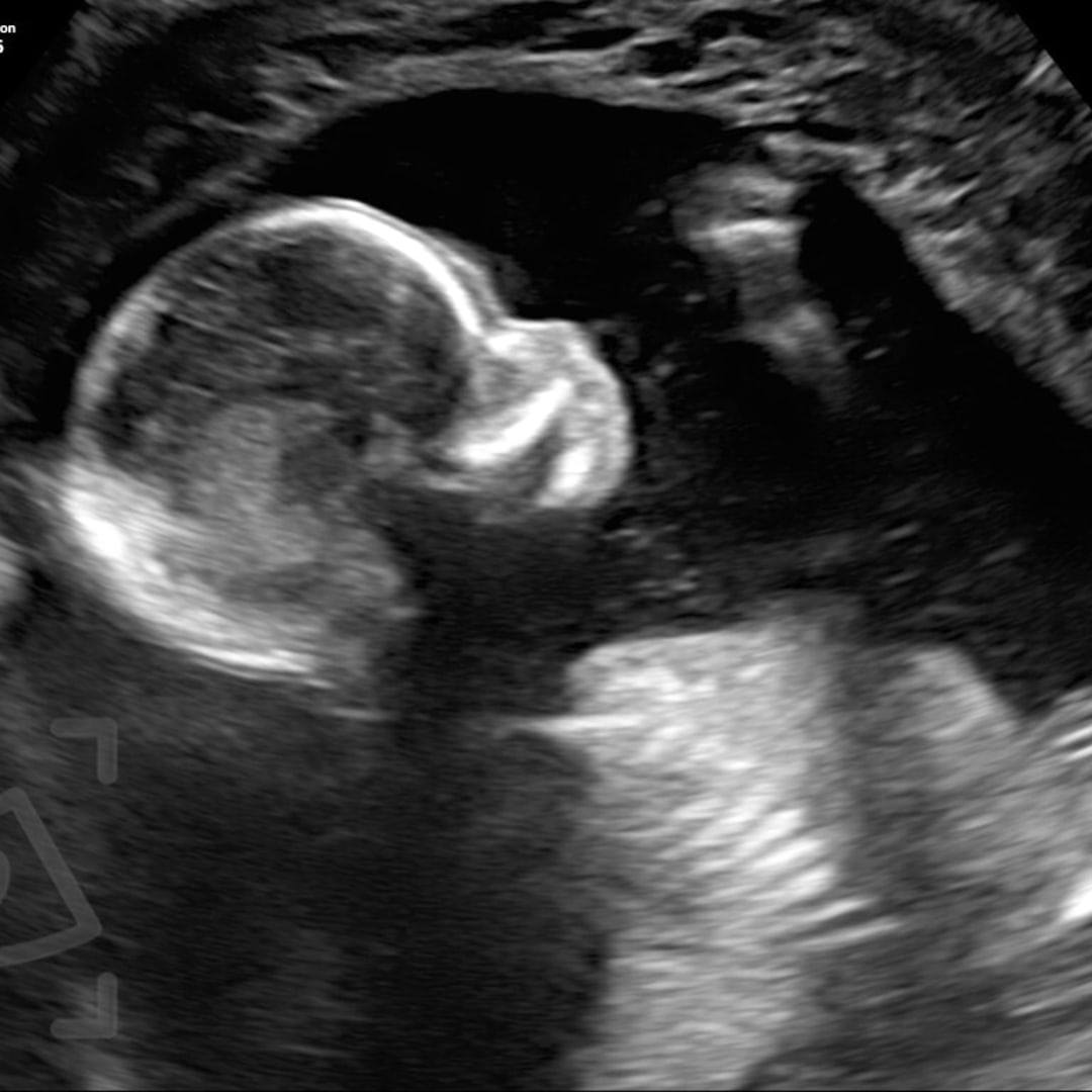 Photo shared by Cooper & Abby for their Babylist baby registry.