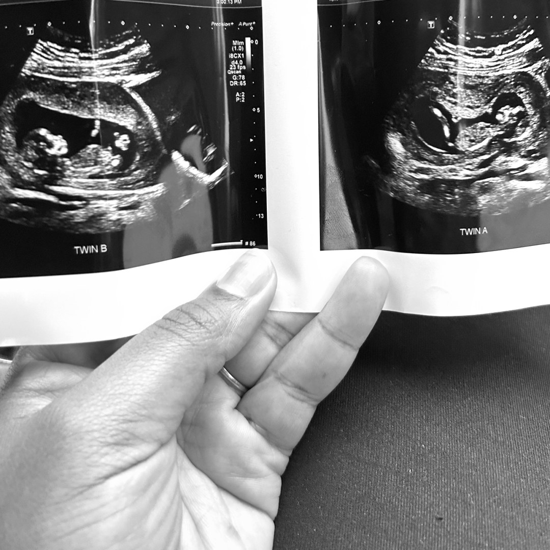 Photo shared by Qui for their Babylist baby registry.