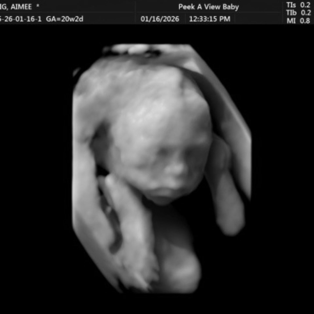 Photo shared by Aimee for their Babylist baby registry.