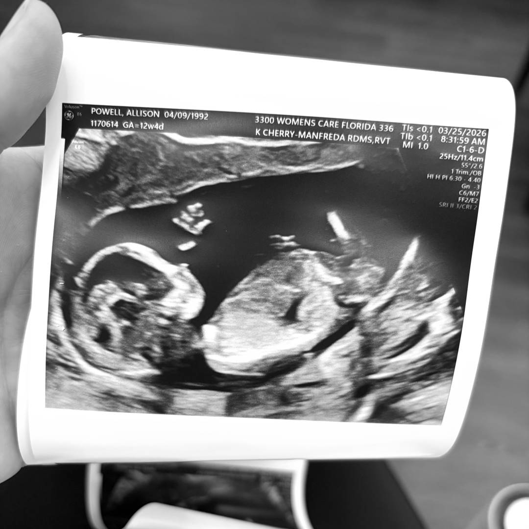 Photo shared by Allison for their Babylist baby registry.